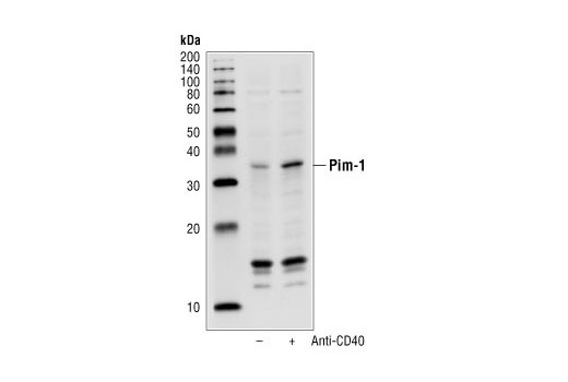 Western Blotting Image 1: Phospho-Pim-1 (Tyr218) Antibody