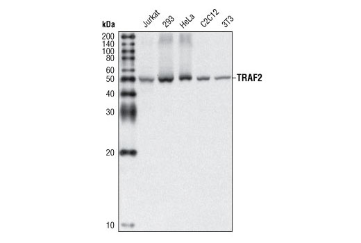  Image 2: TRAF Antibody Sampler Kit