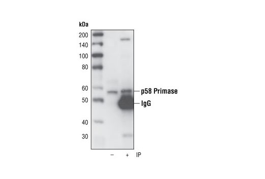 Immunoprecipitation Image 1: p58 Primase (8D3) Rat mAb