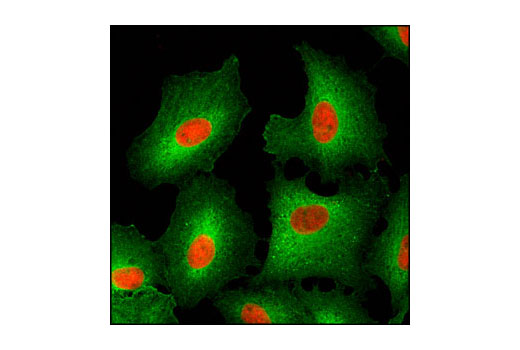 Immunofluorescence Image 1: HSP27 (G31) Mouse mAb (BSA and Azide Free)