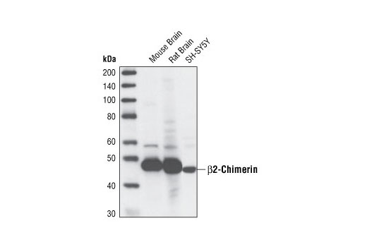 Western Blotting Image 1: β2-Chimerin (2E3) Rat mAb