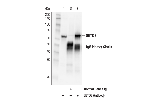 Immunoprecipitation Image 1: SETD3 Antibody