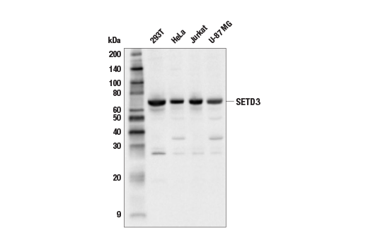 Western Blotting Image 1: SETD3 Antibody