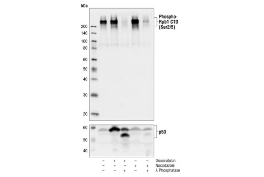 Western Blotting Image 1: Phospho-Rpb1 CTD (Ser2/5) Antibody