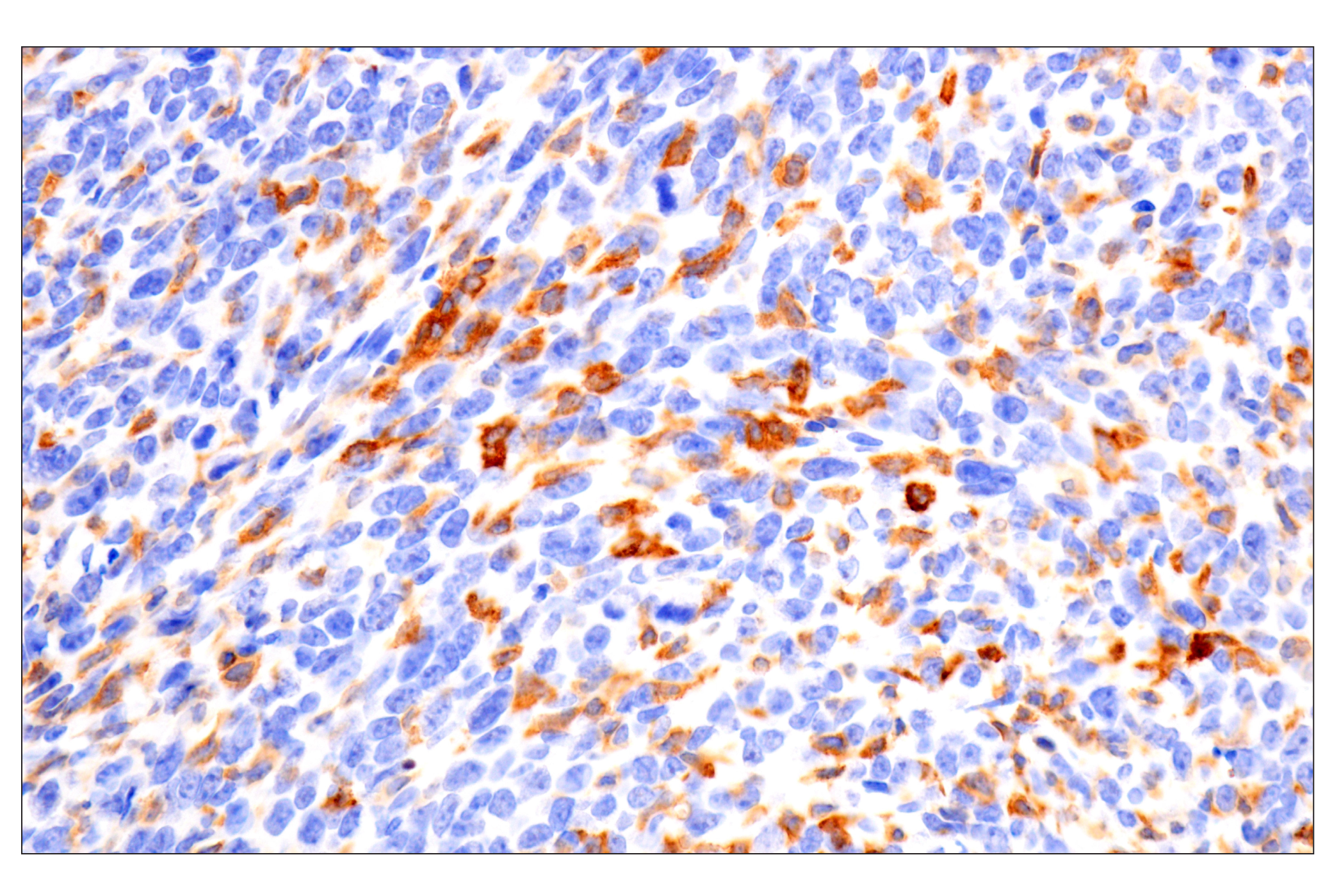 Immunohistochemistry Image 1: CD22 (F9D1W) Rabbit mAb (BSA and Azide Free)