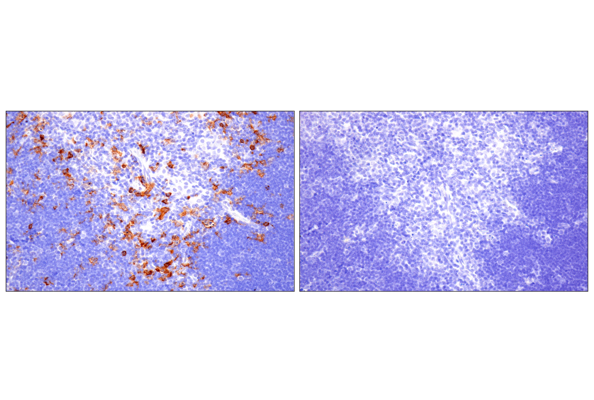 Immunohistochemistry Image 7: CD22 (F9D1W) Rabbit mAb (BSA and Azide Free)