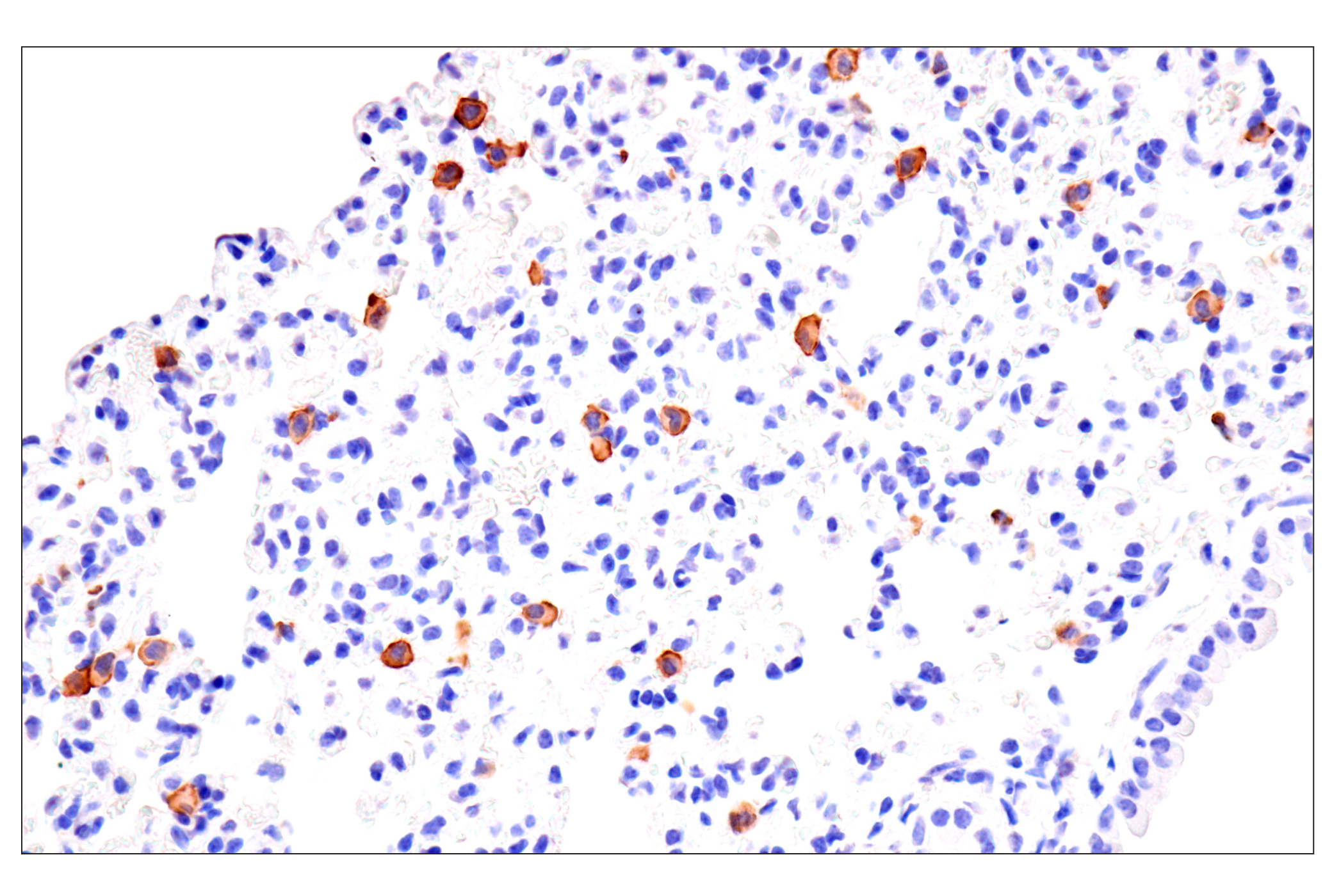 Immunohistochemistry Image 6: CD22 (F9D1W) Rabbit mAb (BSA and Azide Free)
