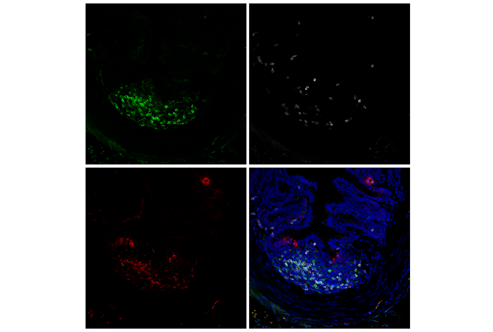 Immunofluorescence Image 1: CD22 (F9D1W) Rabbit mAb (BSA and Azide Free)