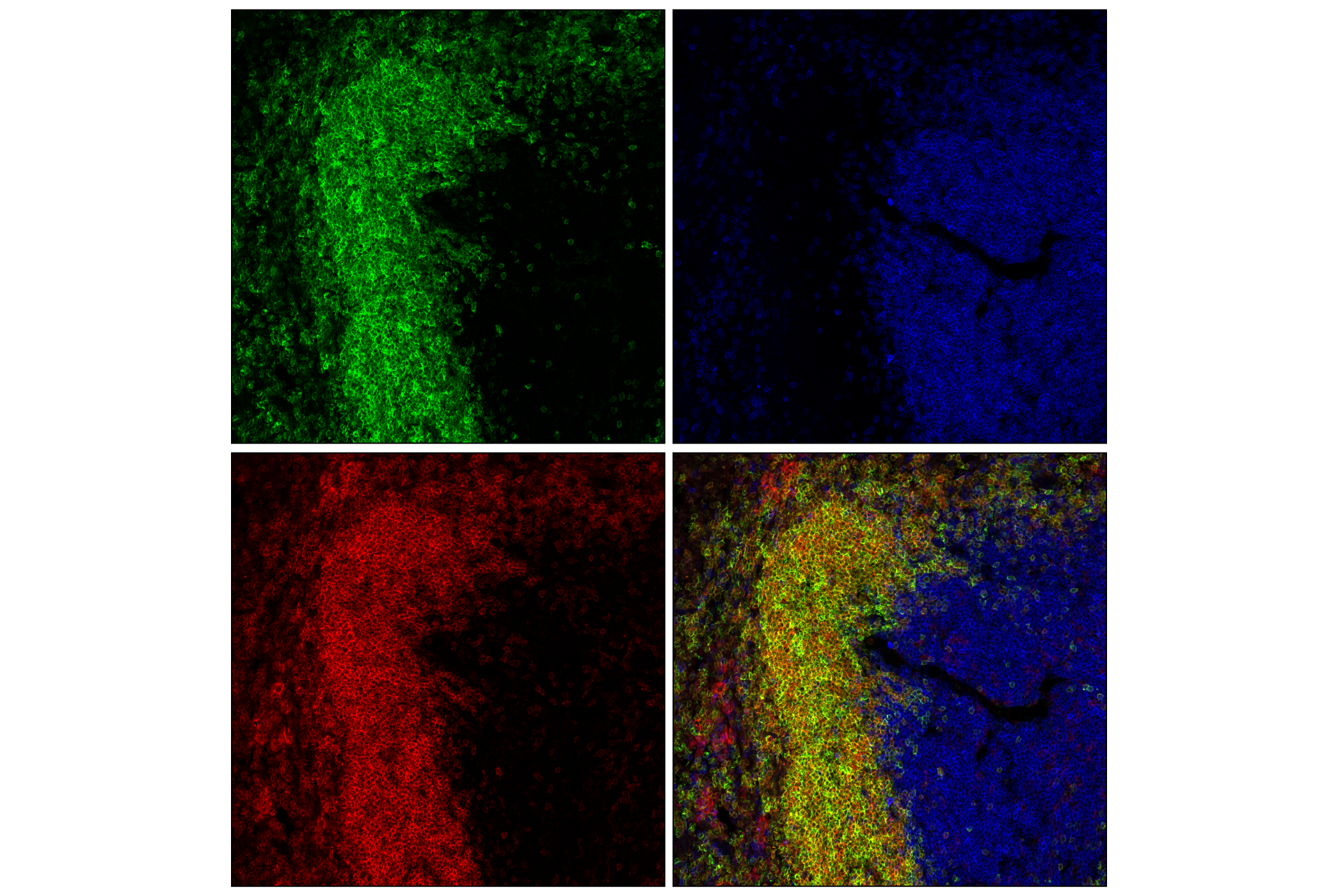 Immunofluorescence Image 2: CD22 (F9D1W) Rabbit mAb (BSA and Azide Free)