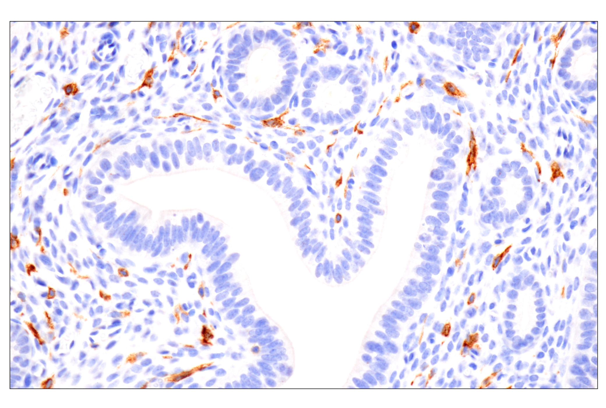Immunohistochemistry Image 3: CD22 (F9D1W) Rabbit mAb (BSA and Azide Free)