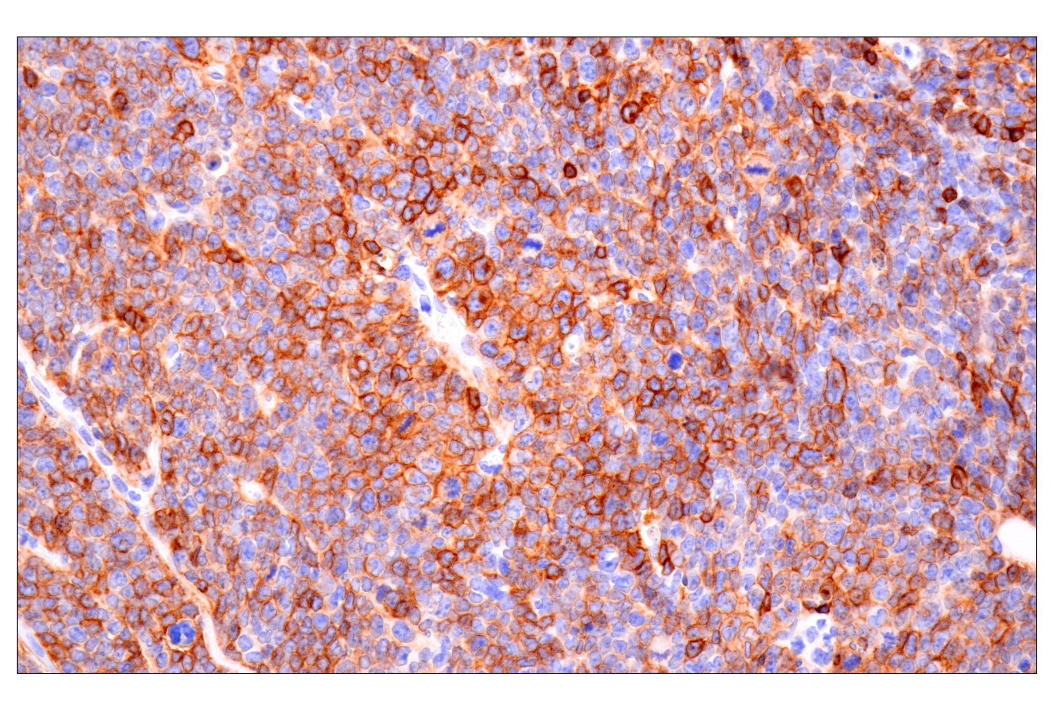 Immunohistochemistry Image 4: CD22 (F9D1W) Rabbit mAb (BSA and Azide Free)