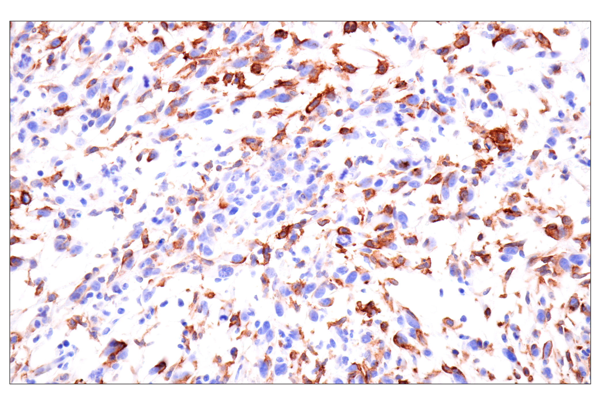 Immunohistochemistry Image 5: CD22 (F9D1W) Rabbit mAb (BSA and Azide Free)