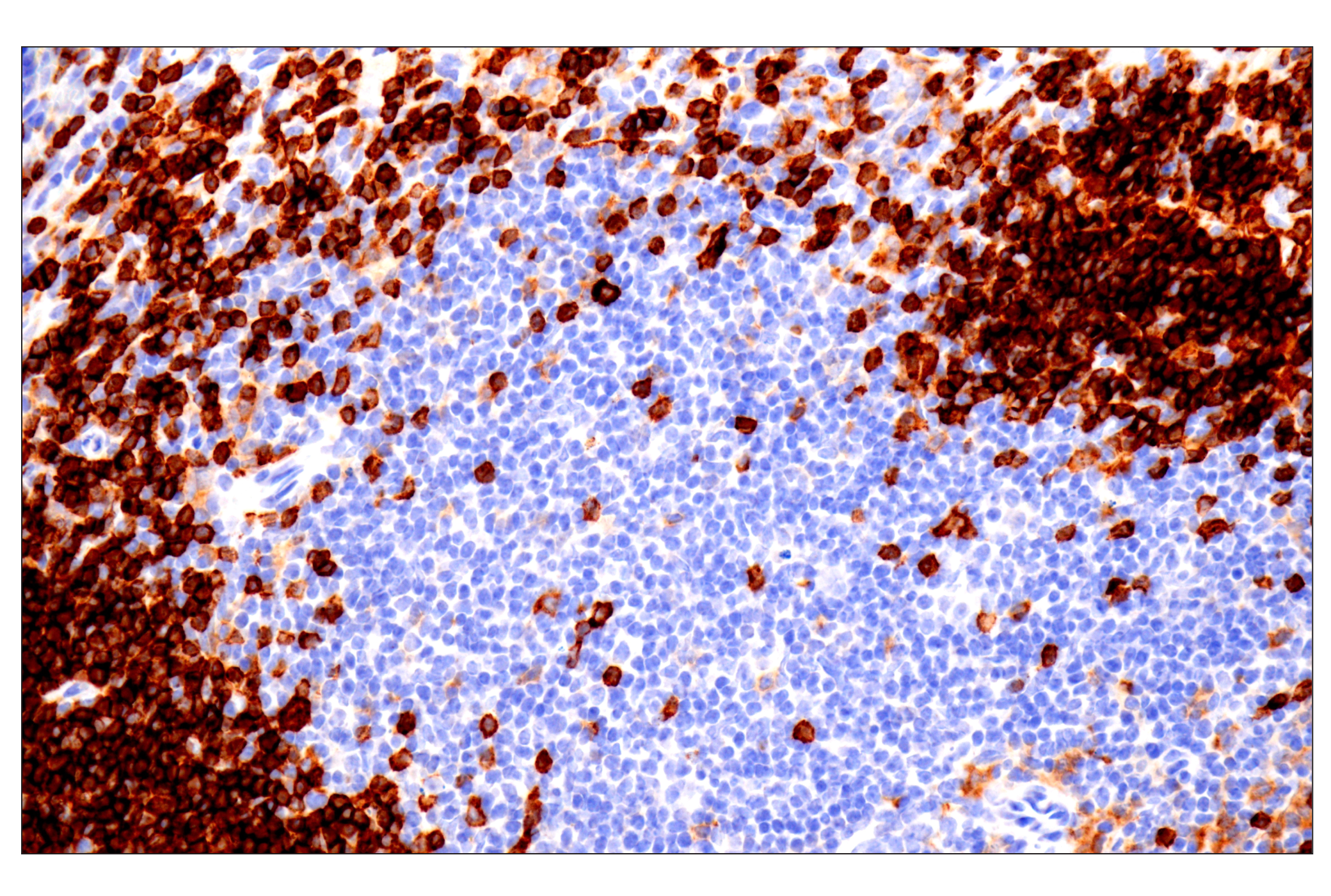 Immunohistochemistry Image 2: CD22 (F9D1W) Rabbit mAb (BSA and Azide Free)