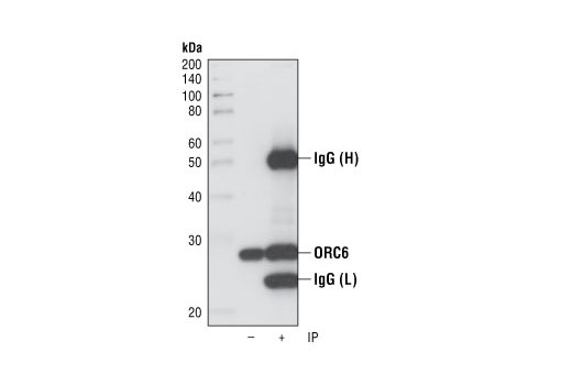 Immunoprecipitation Image 1: ORC6 (3A4) Rat mAb