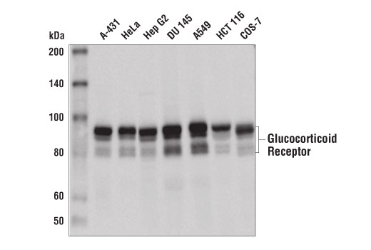 Western Blotting Image 1: Glucocorticoid Receptor (D4X9S) Mouse mAb