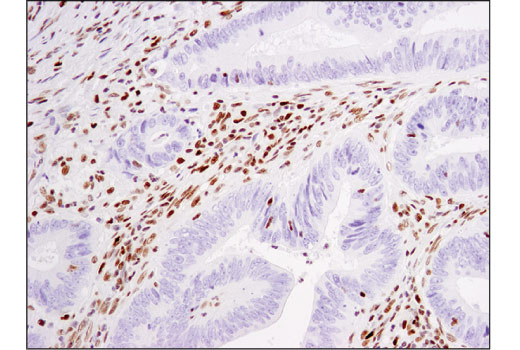 Immunohistochemistry Image 1: Glucocorticoid Receptor (D4X9S) Mouse mAb
