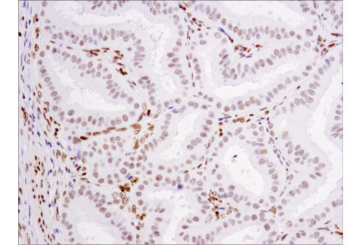 Immunohistochemistry Image 2: Glucocorticoid Receptor (D4X9S) Mouse mAb