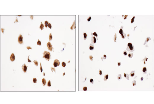 Immunohistochemistry Image 3: Glucocorticoid Receptor (D4X9S) Mouse mAb