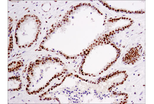 Immunohistochemistry Image 4: Glucocorticoid Receptor (D4X9S) Mouse mAb