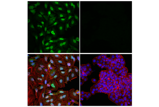 Immunofluorescence Image 1: Glucocorticoid Receptor (D4X9S) Mouse mAb