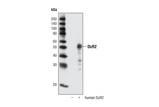 Western Blotting Image 1: DcR2 Antibody