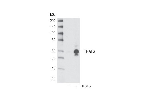 Western Blotting Image 1: TRAF6 Antibody
