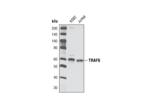 Western Blotting Image 2: TRAF6 Antibody
