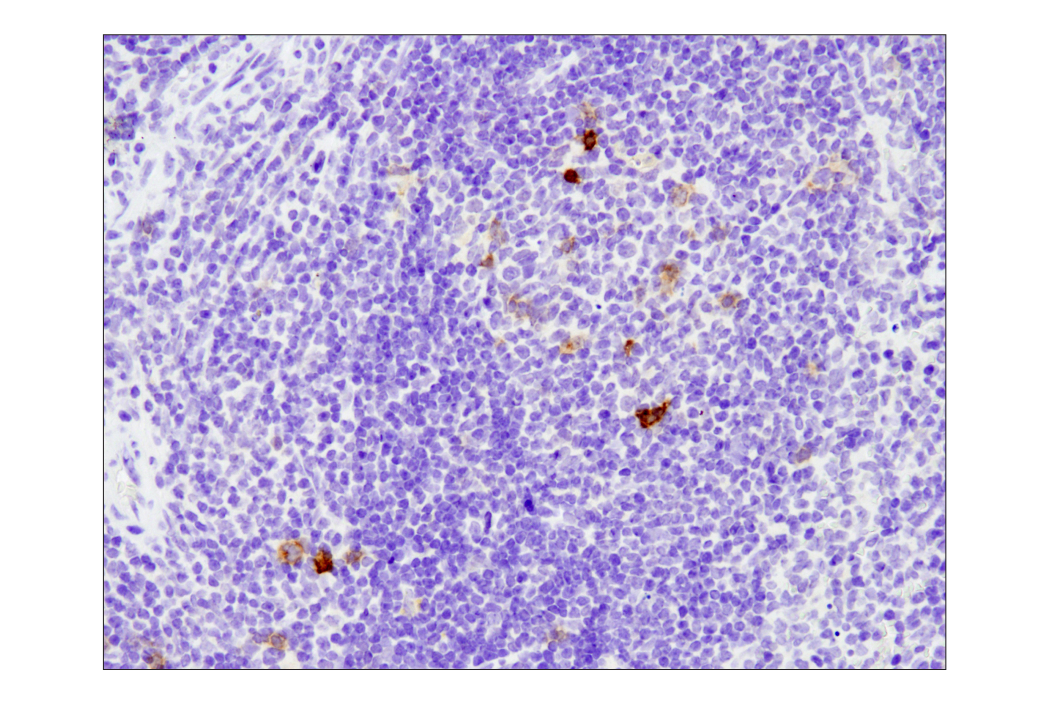 Immunohistochemistry Image 8: TNFRSF8/CD30 (E4L4I) XP® Rabbit mAb (BSA and Azide Free)