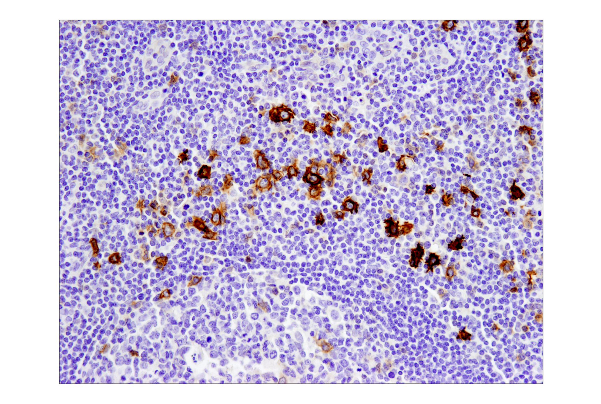 Immunohistochemistry Image 7: TNFRSF8/CD30 (E4L4I) XP® Rabbit mAb (BSA and Azide Free)