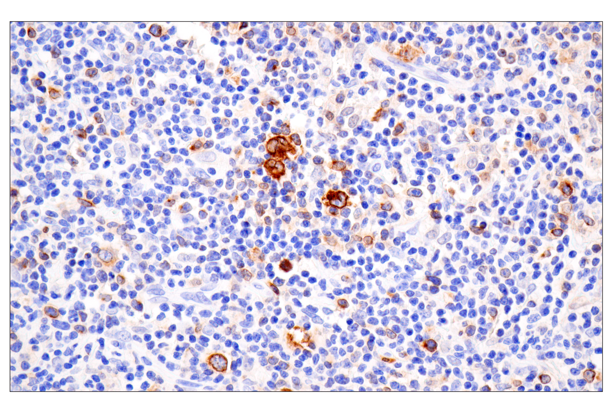 Immunohistochemistry Image 4: TNFRSF8/CD30 (E4L4I) XP® Rabbit mAb (BSA and Azide Free)
