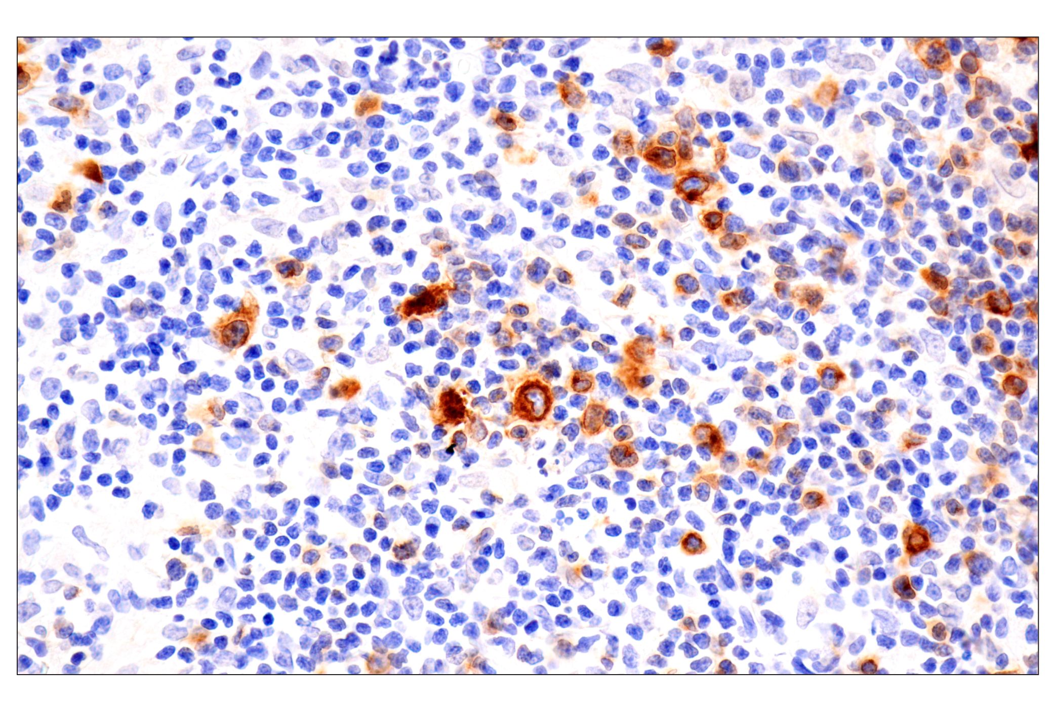 Immunohistochemistry Image 1: TNFRSF8/CD30 (E4L4I) XP® Rabbit mAb (BSA and Azide Free)