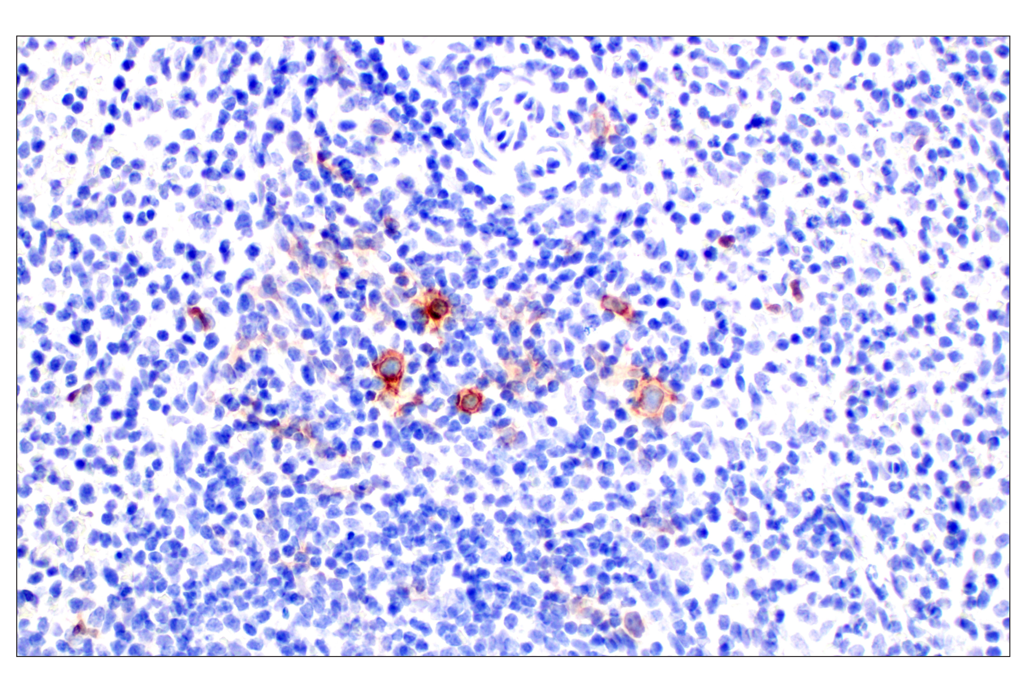 Immunohistochemistry Image 3: TNFRSF8/CD30 (E4L4I) XP® Rabbit mAb (BSA and Azide Free)
