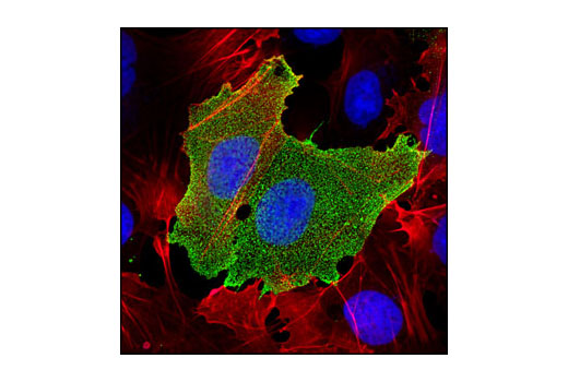 Immunofluorescence Image 1: TRA-1-81 (TRA-1-81) Mouse mAb