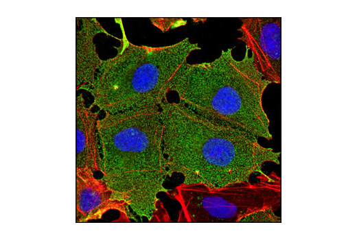 Immunofluorescence Image 1: TRA-1-60(S) (TRA-1-60(S)) Mouse mAb