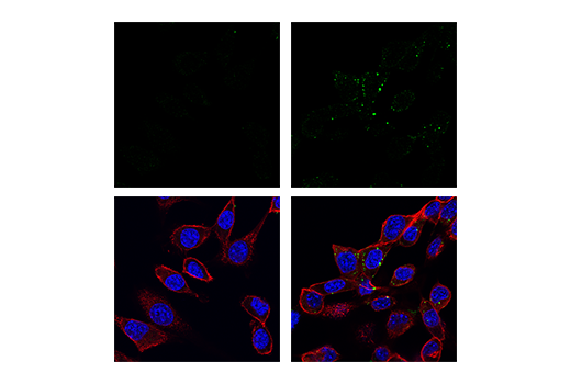 Immunofluorescence Image 1: Phospho-RIP3 (Thr231/Ser232) (E7S1R) Rabbit mAb (Alexa Fluor® 488 Conjugate)