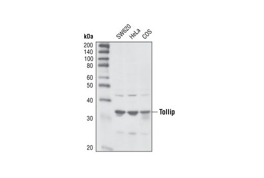 Western Blotting Image 1: Tollip Antibody