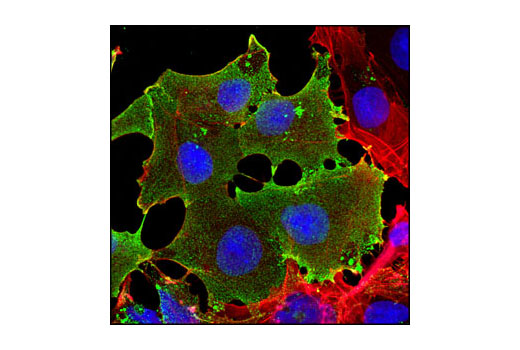 Immunofluorescence Image 1: SSEA4 (MC813) Mouse mAb