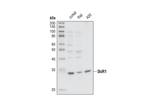 Western Blotting Image 1: DcR1 Antibody