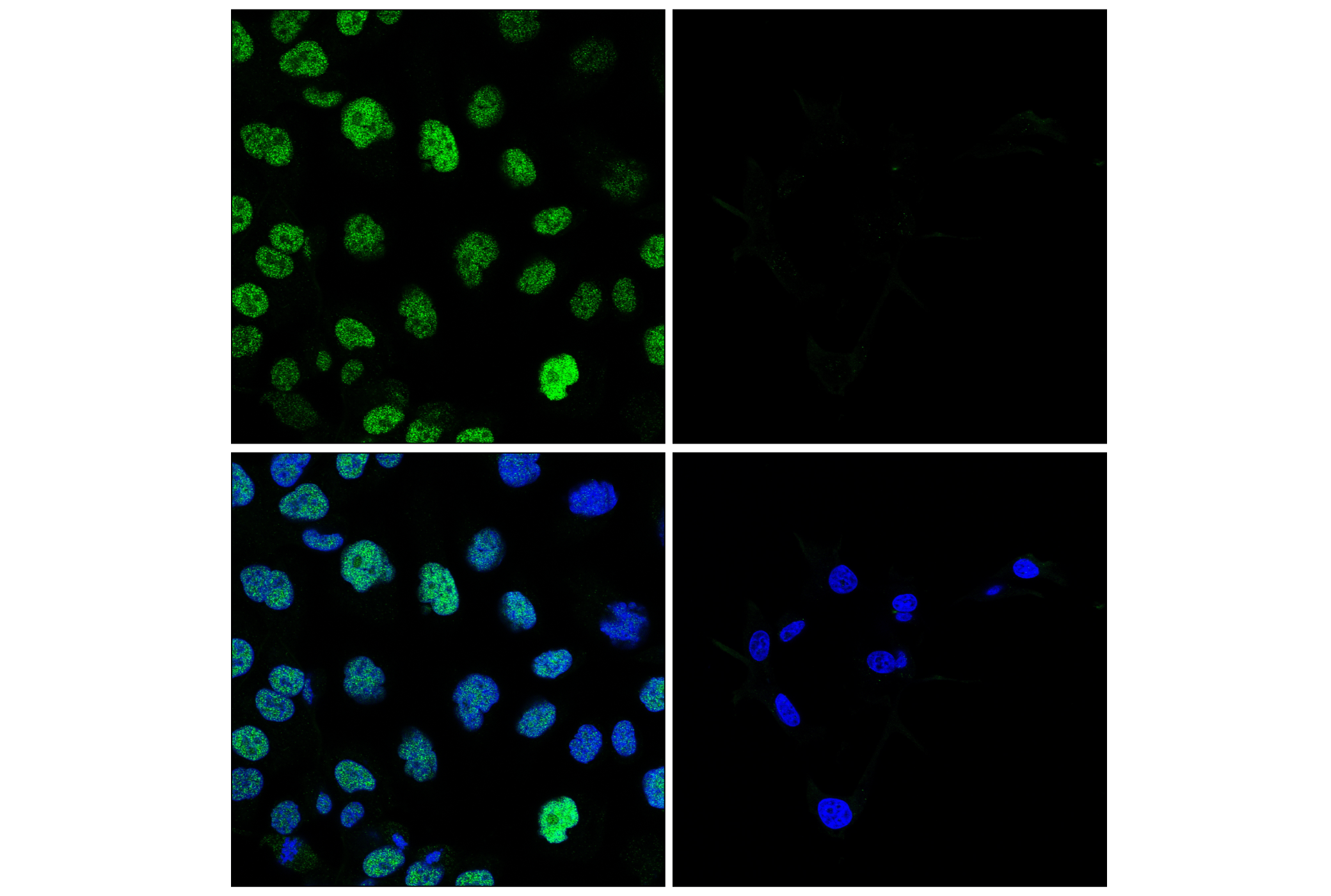 Immunofluorescence Image 1: MLLT3 (E5Z7U) Rabbit mAb