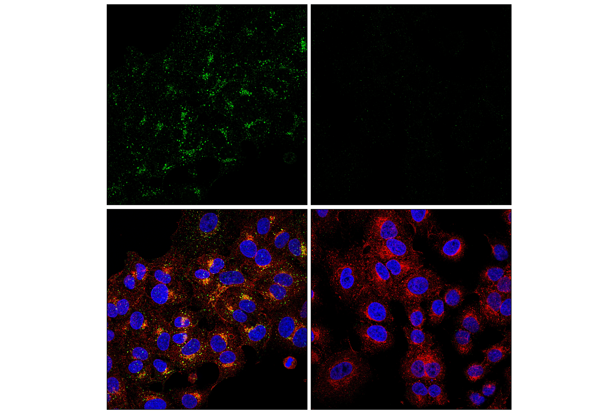 Immunofluorescence Image 1: APP (E8B3O) XP® Rabbit mAb (BSA and Azide Free)