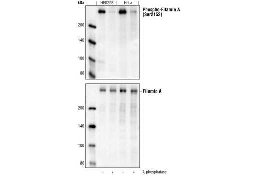 Western Blotting Image 1: Phospho-Filamin A (Ser2152) Antibody