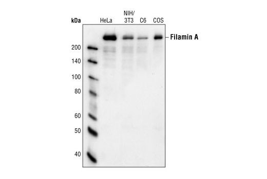 Western Blotting Image 1: Filamin A Antibody