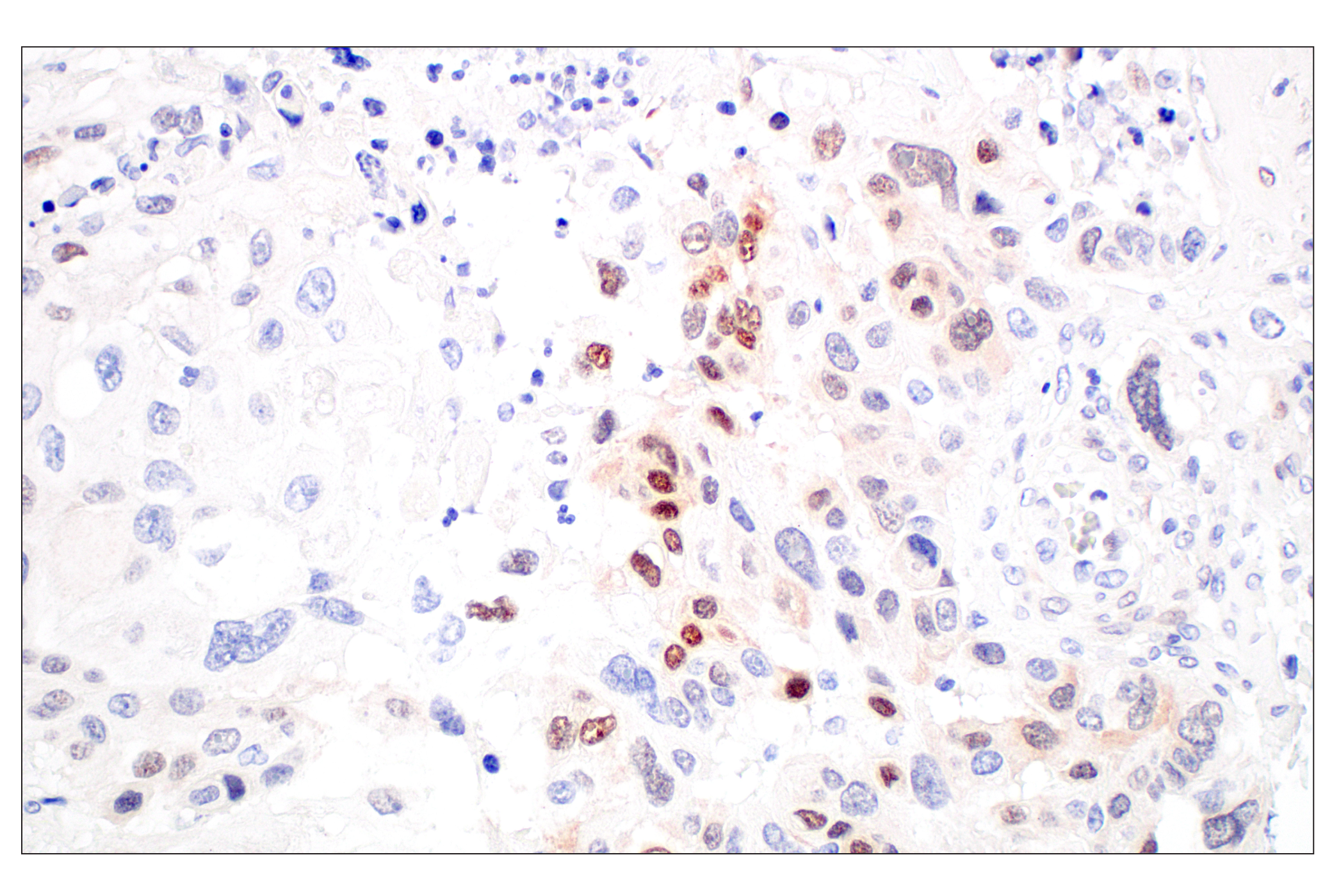 Immunohistochemistry Image 7: ARK5 (E4T2A) Rabbit mAb