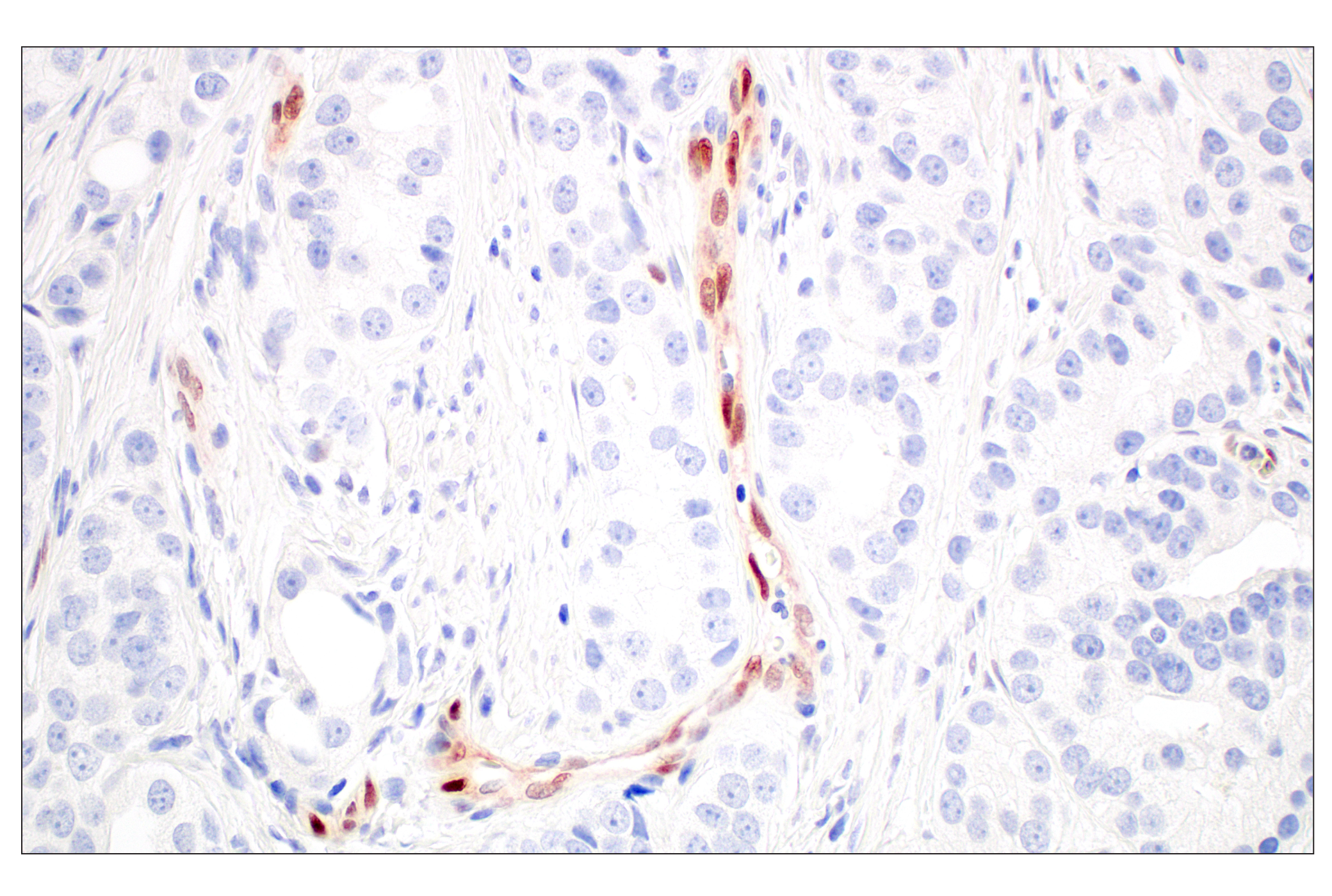 Immunohistochemistry Image 9: ARK5 (E4T2A) Rabbit mAb