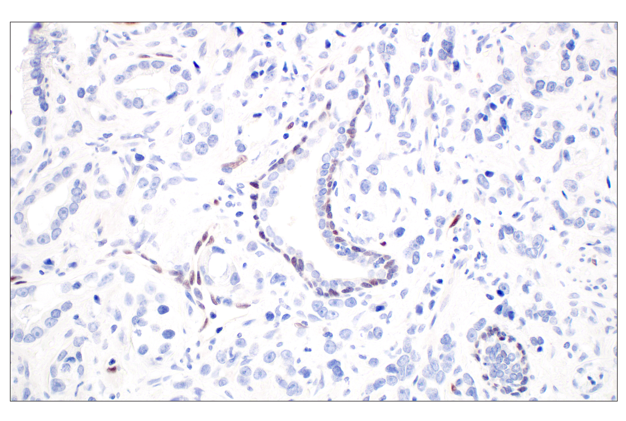 Immunohistochemistry Image 6: ARK5 (E4T2A) Rabbit mAb