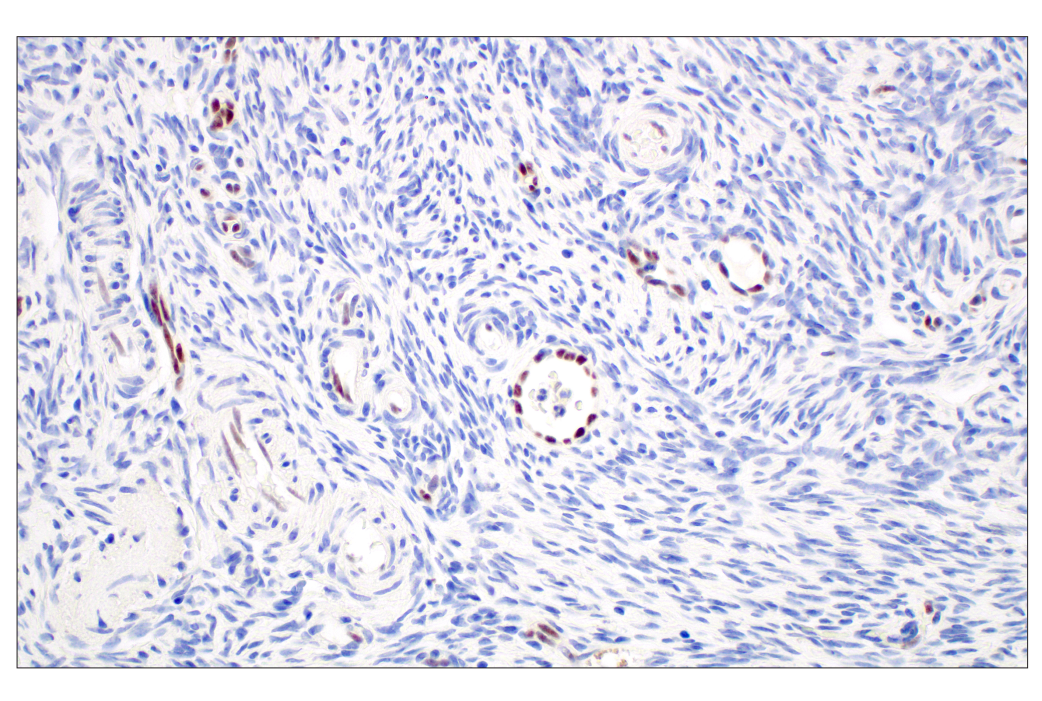 Immunohistochemistry Image 8: ARK5 (E4T2A) Rabbit mAb