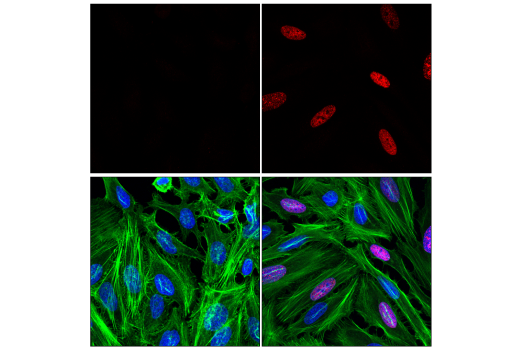 Immunofluorescence Image 1: Phospho-RPA32/RPA2 (Ser8) (E5A2F) Rabbit mAb (Alexa Fluor® 647 Conjugate)