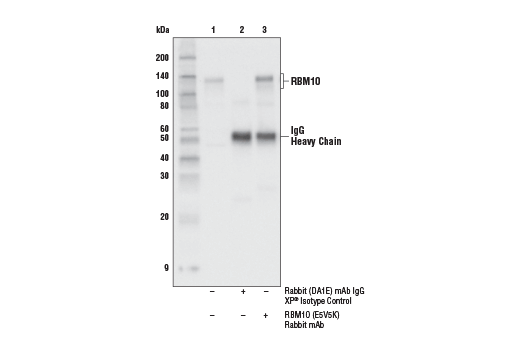 Immunoprecipitation Image 1: RBM10 (E5V5K) Rabbit mAb