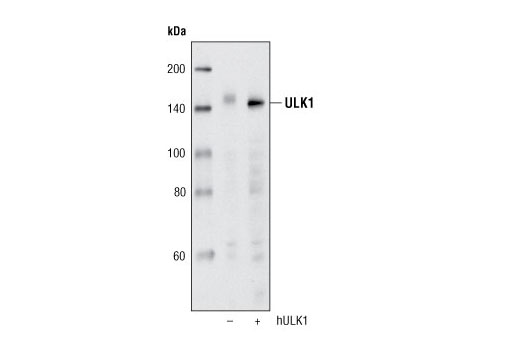 Western Blotting Image 1: ULK1 (R600) Antibody
