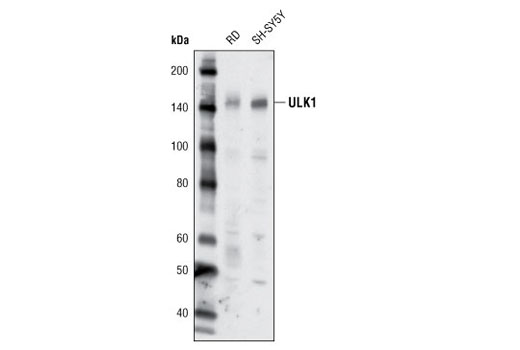 Western Blotting Image 2: ULK1 (R600) Antibody